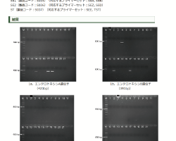 画像:黄色ブドウ球菌のエンテロトキシン毒素遺伝子及び毒素性ショック症候群
毒素遺伝子の検出