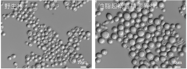 Lipomyces属の顕微鏡写真